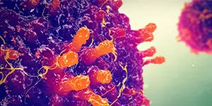 Measles viral infection